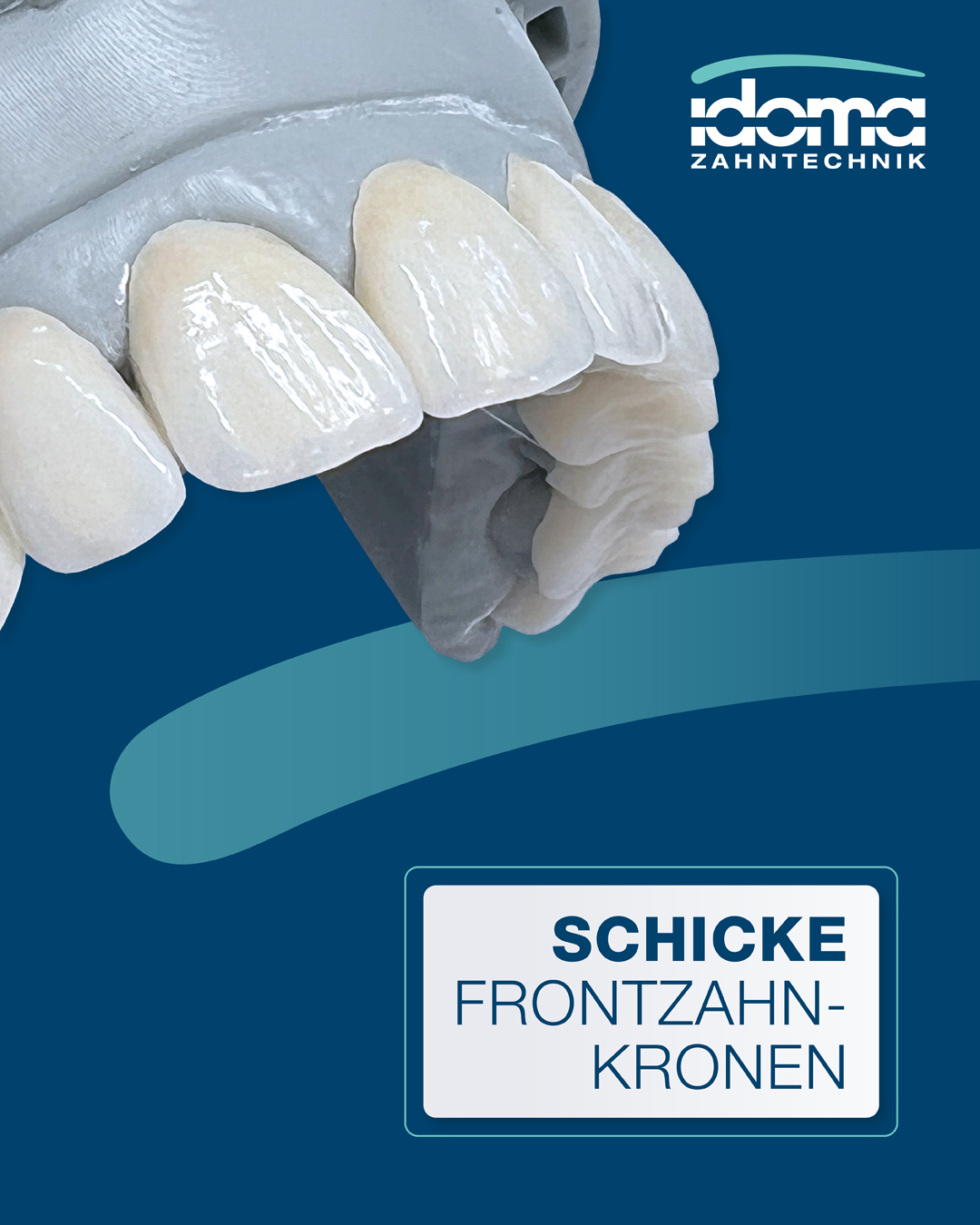 IDOMA Dental News - Unsichtbare Perfektion – unsere IDOMA-Frontzahnkronen!
