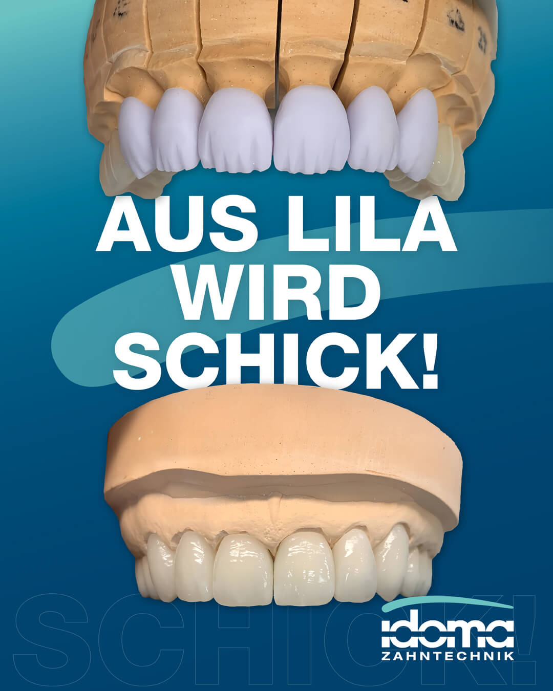 IDOMA Dental - News - Aus Lila wird schick – und zwar richtig schick!