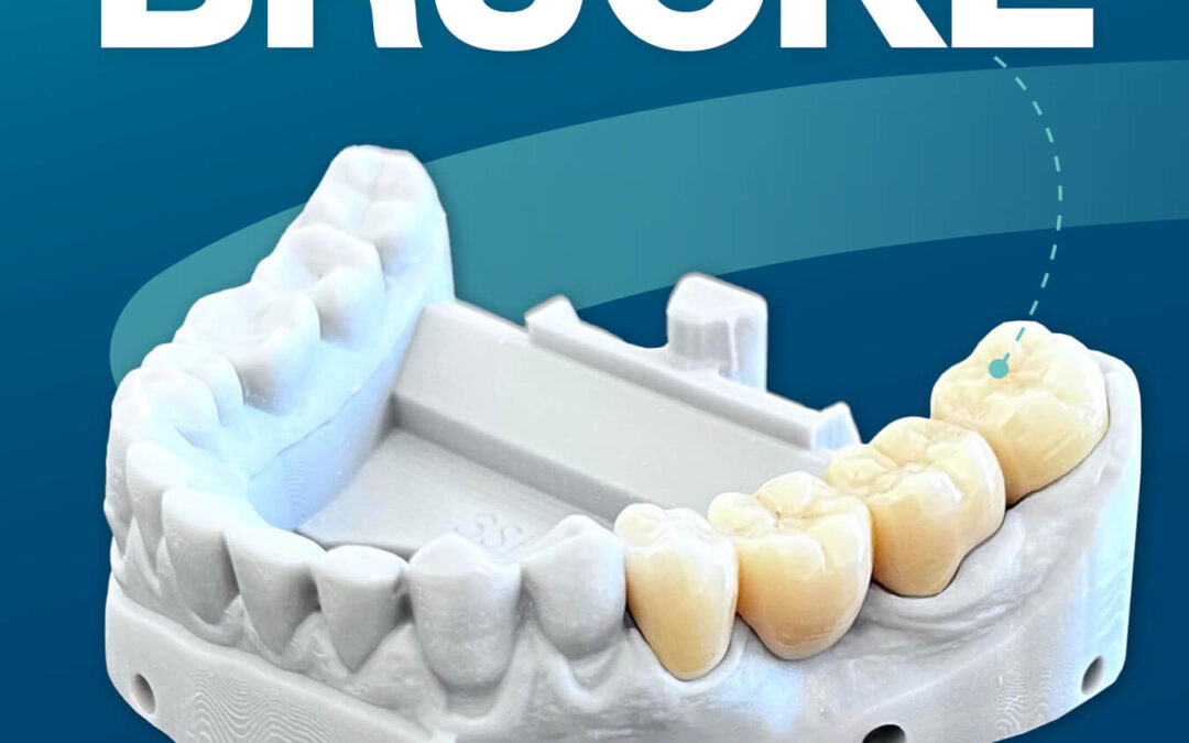 Schick schick! – Brücken von IDOMA
