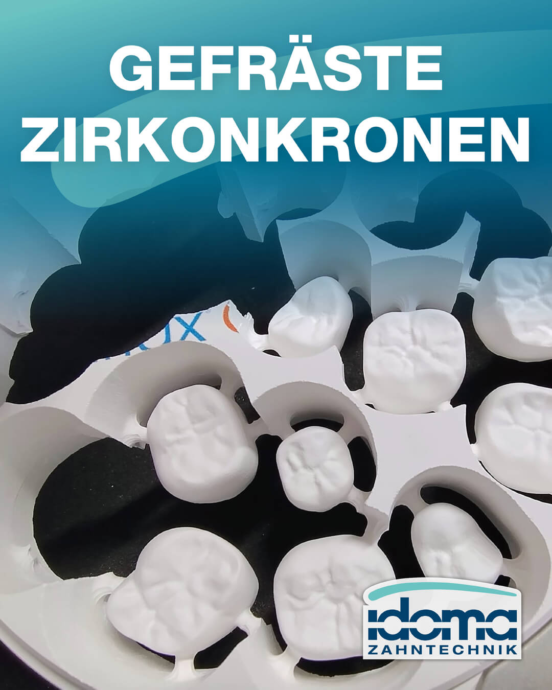 IDOMA Zahntechnik - News - Zirkonkronen fräsen - Hightech trifft Handwerk