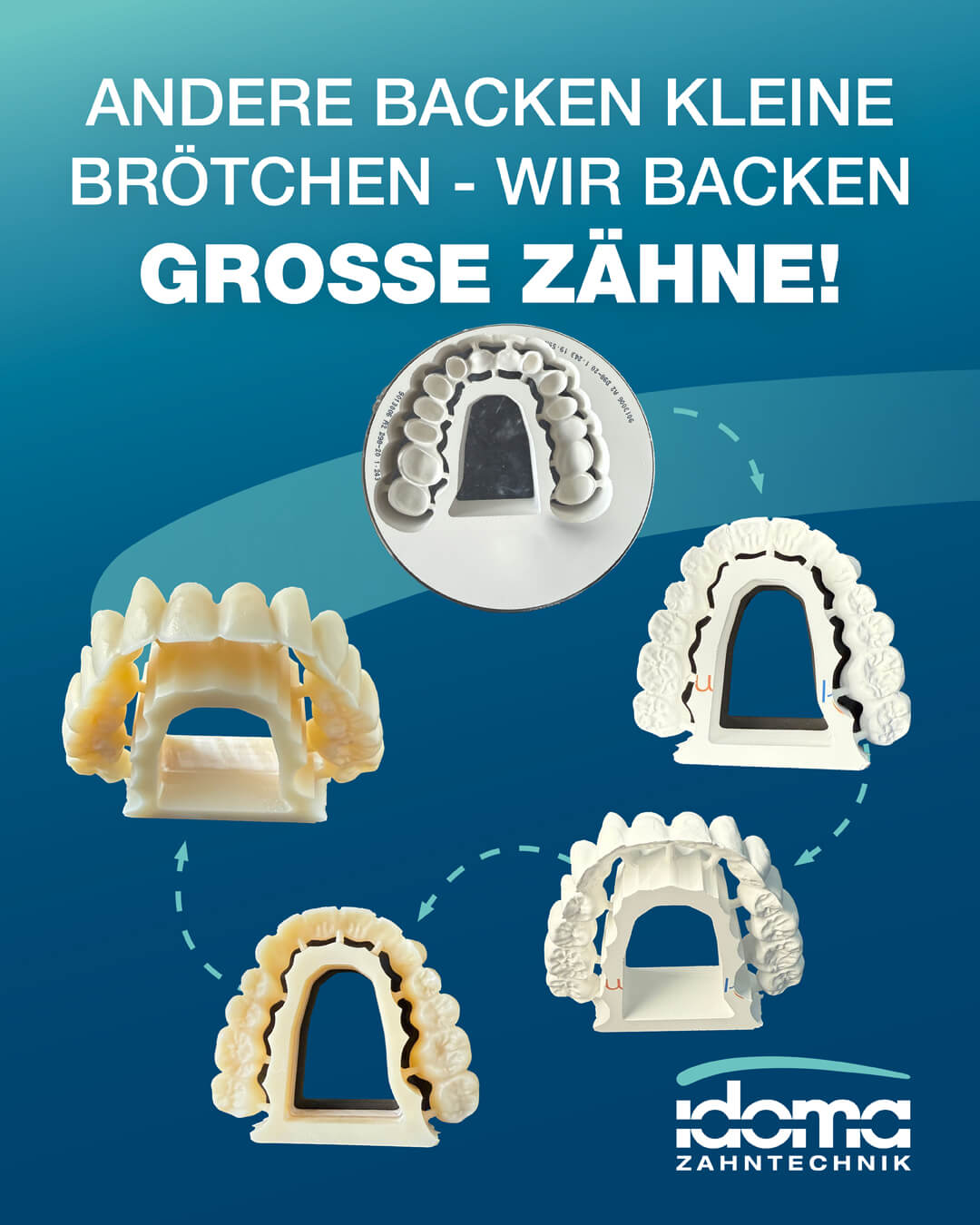 IDOMA Zahntechnik - News - Andere backen kleine Brötchen – wir backen große Zähne!
