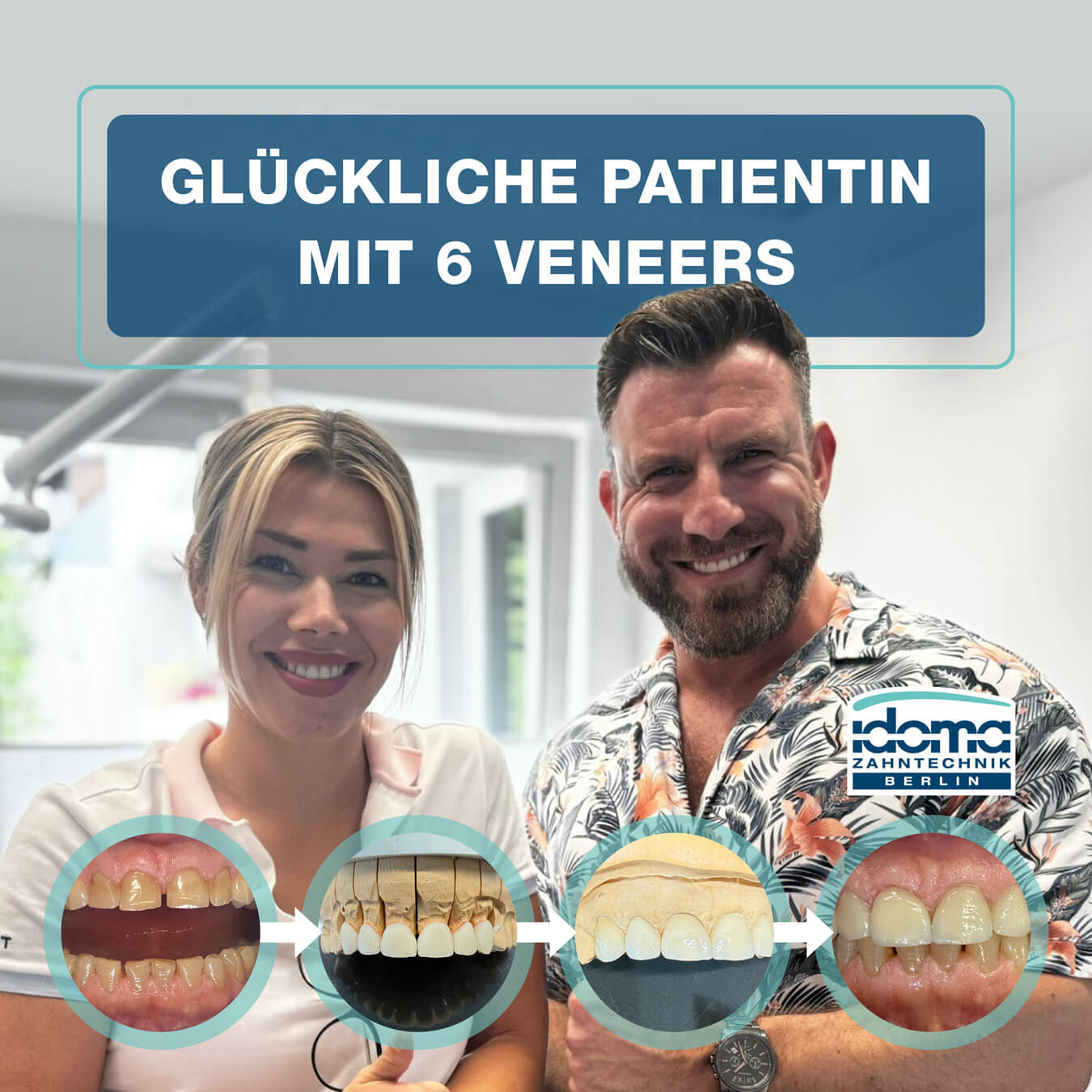 IDOMA Zahntechnik - News - Neues Lächeln mit 6 Veneers
