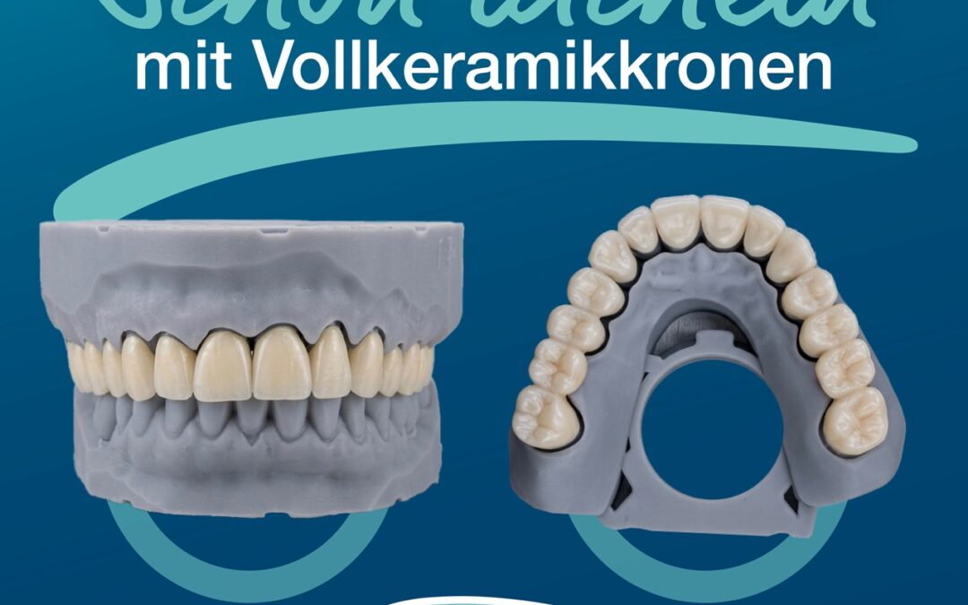 Schön lächeln mit Vollkeramikkronen